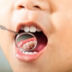 Cuidados com saúde bucal dos bebês devem começar na gestação